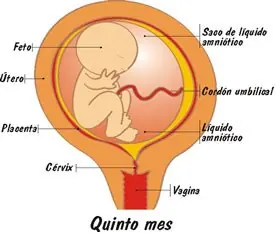 pro vida