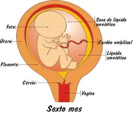 pro aborto