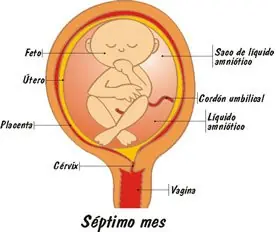 despenalizacion