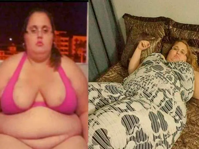 Llegó a pesar 150 kilos, se sometió a una cirugía y hoy luce