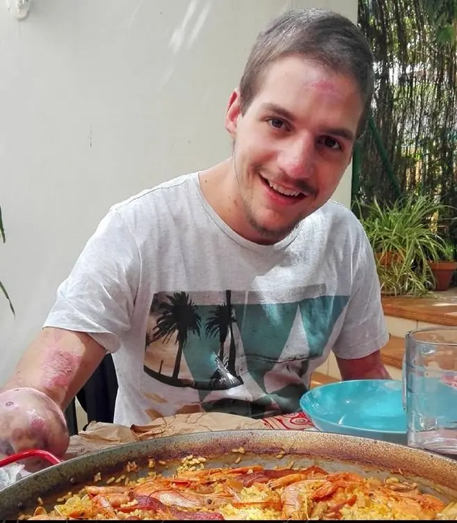 Joven facha pierde los brazos y piernas menos la sonrisa