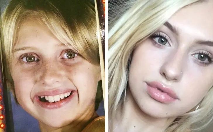 15 Personas que tenían baja autoestima en la adolescencia