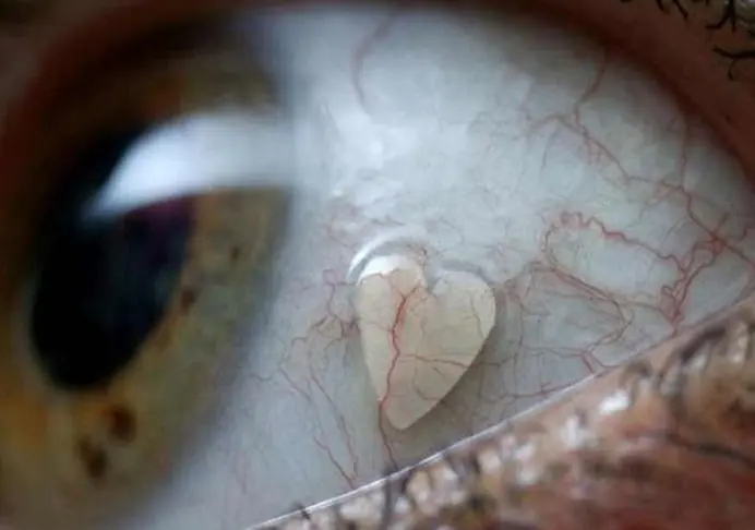 En los ojos