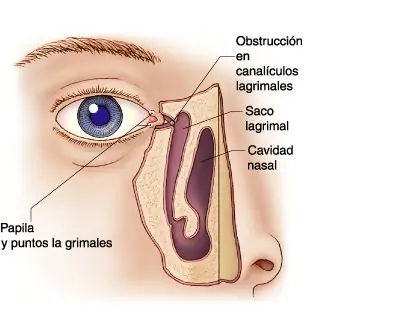 llanto