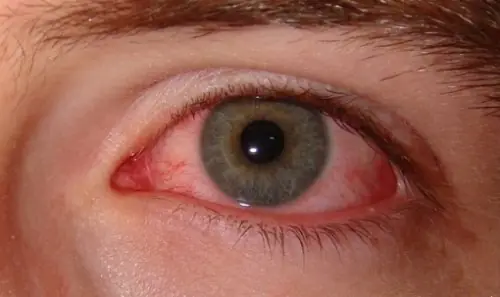 ojos