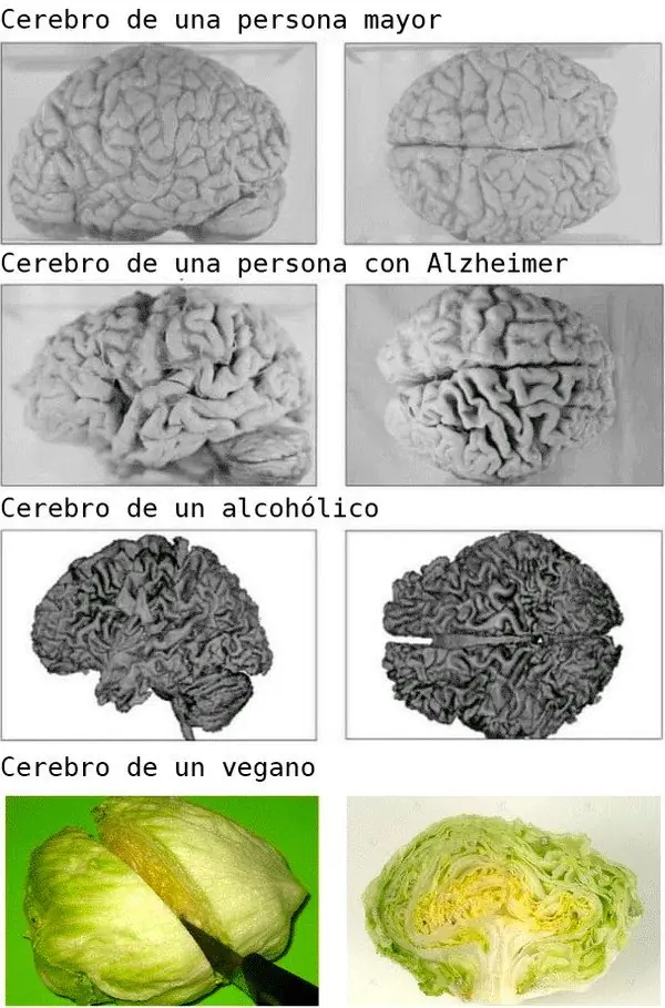 Humor oscuro: Te dolerá el diafragma después reír tanto