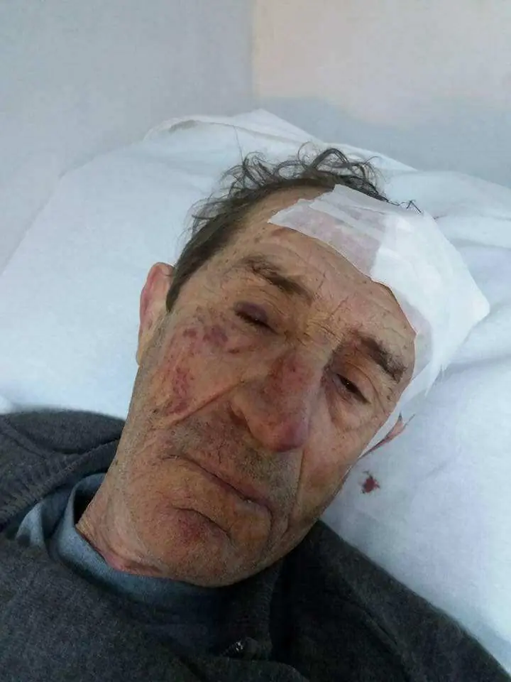 Abuelo golpeado y torturado durante una entradera en Sarandí