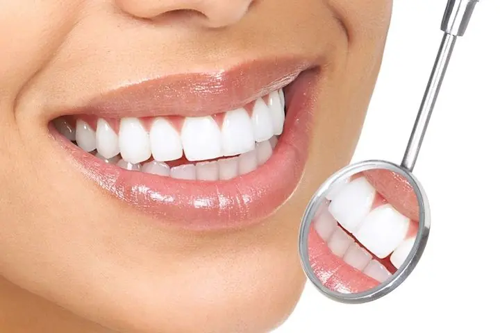 Conoce los problemas que puede generar la maloclusión dental