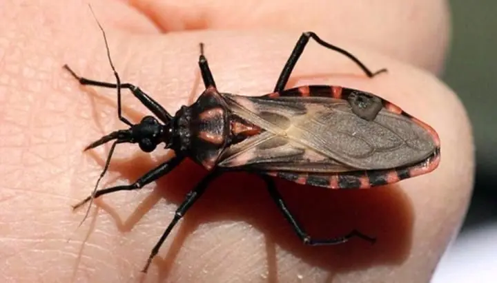 chagas