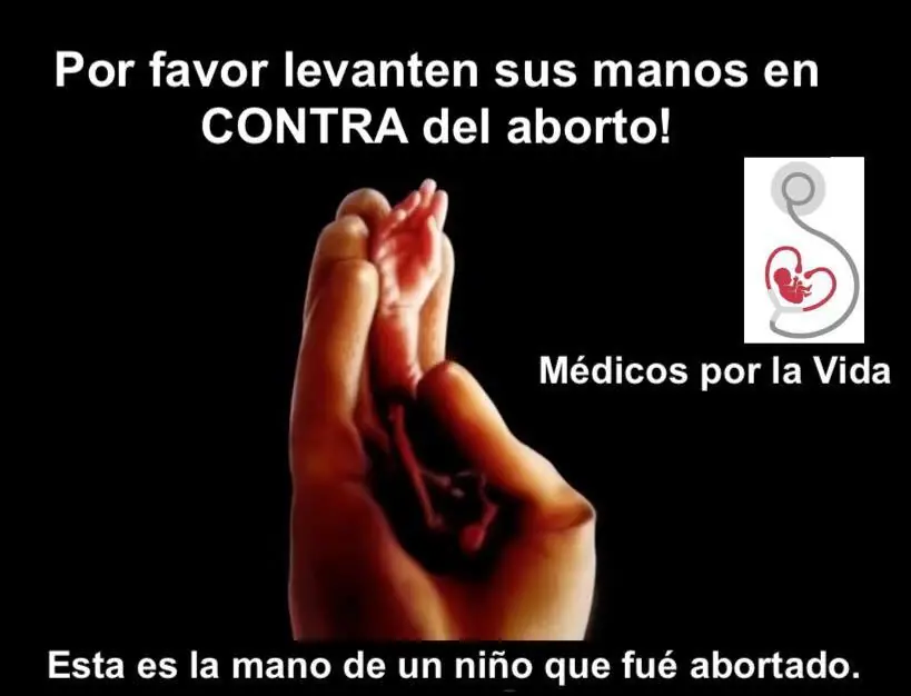 sindrome