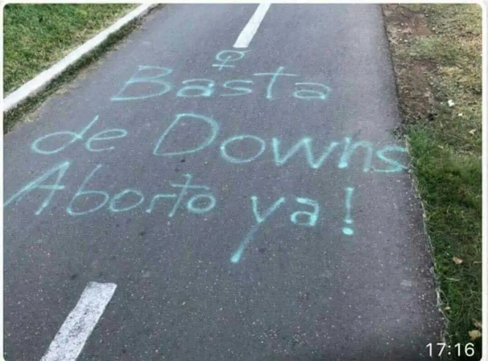 Aborto: Eliminar el Sindrome de Down al 9no mes