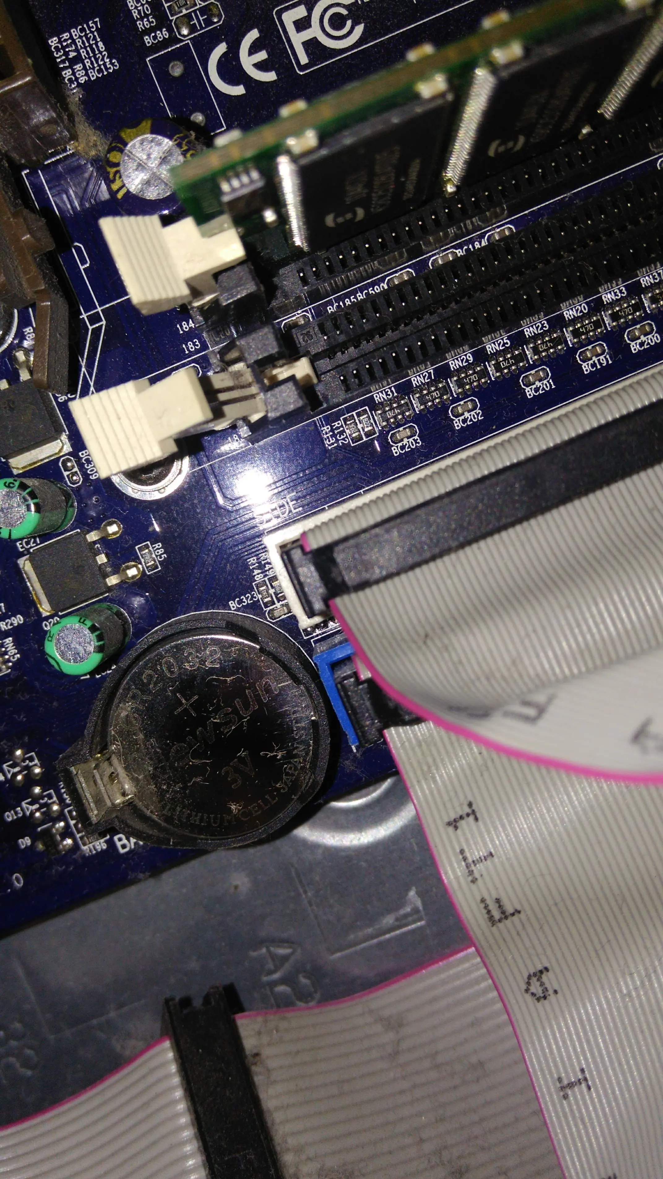 ultrasonidos