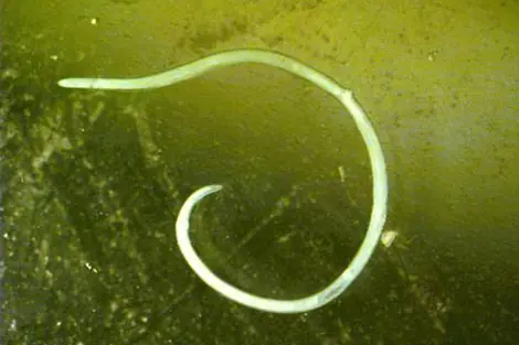 parasito Tenia o Solitaria
