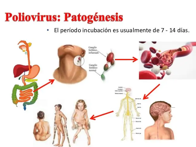 RETROVIRUS