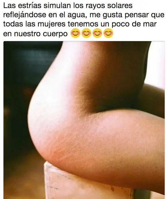 sonrisa