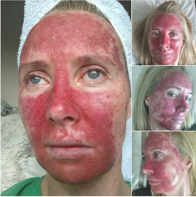 Mujer publica impactantes imágenes