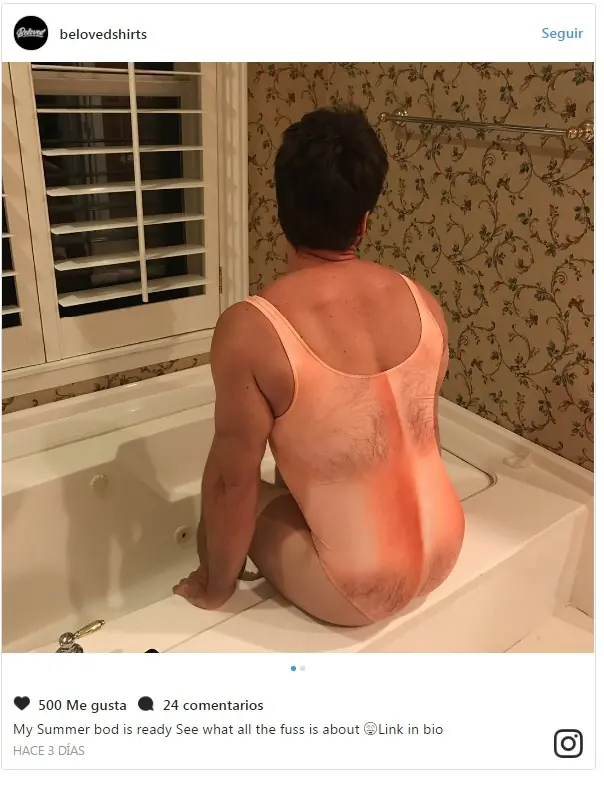 Está de pelos: extraño traje de baño desconcierta la web