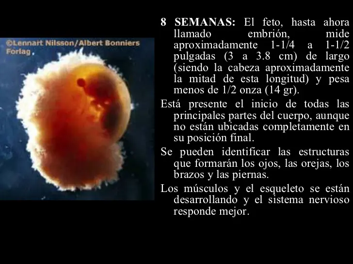 aborto