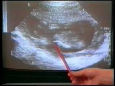 Aborto en Francia: 43 años de experiencia para reflexionar