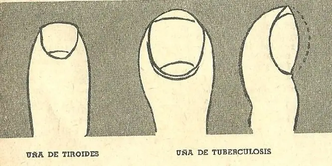 quirologia