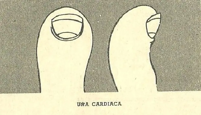 curiosos