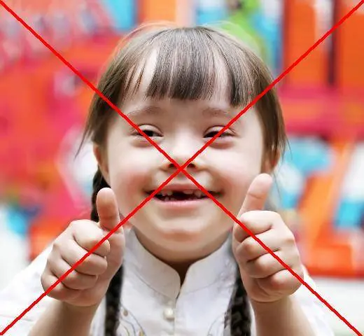 Aborto evita tener chico Down