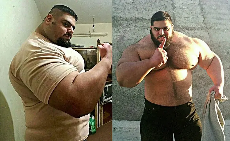 gigantismo