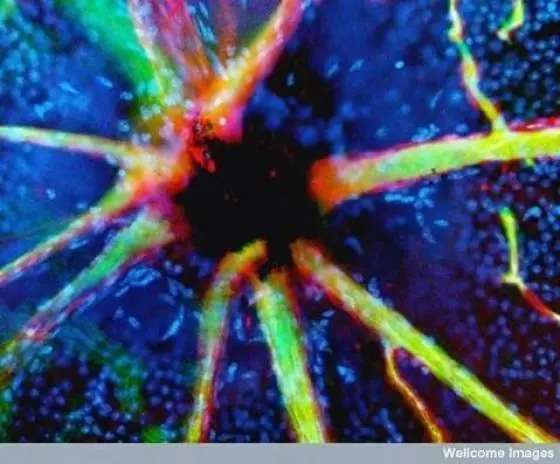 Microscopio