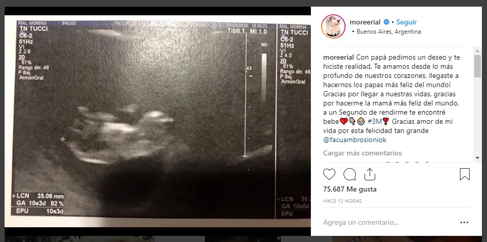 Ultimo momento! More Rial embarazada