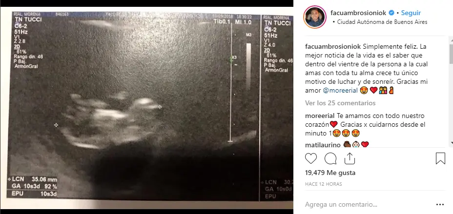kun aguero