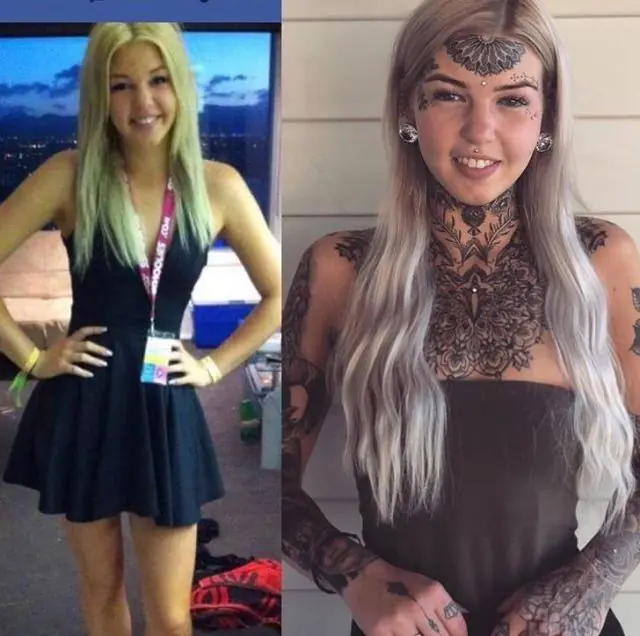 El antes y después de la "mujer serpiente" (FOTOS)