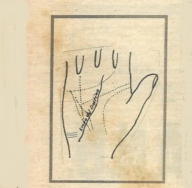 para