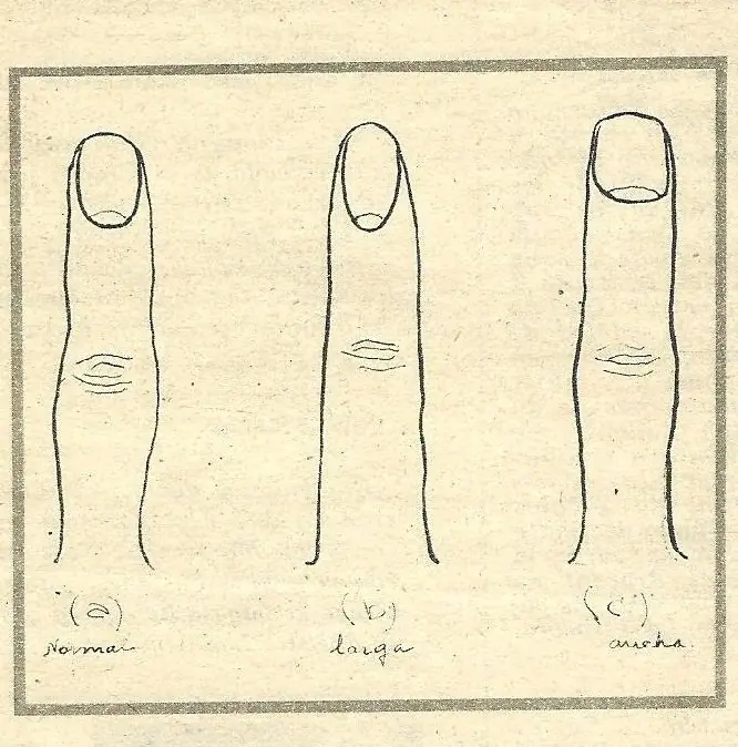 para